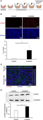 Irradiation Induces Epithelial Cell Unjamming